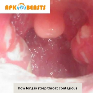 How Long Is Strep Throat Contagious?